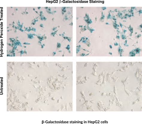 beta galactosidase assay|Senescence.